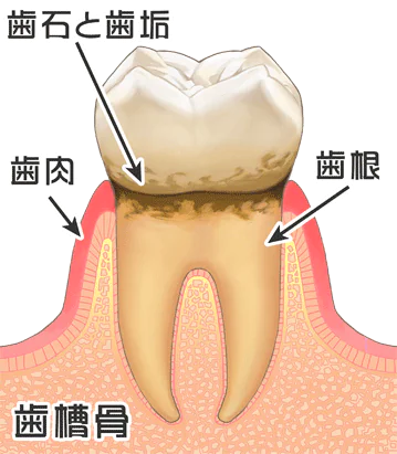 口や歯がザラザラする・気になる原因